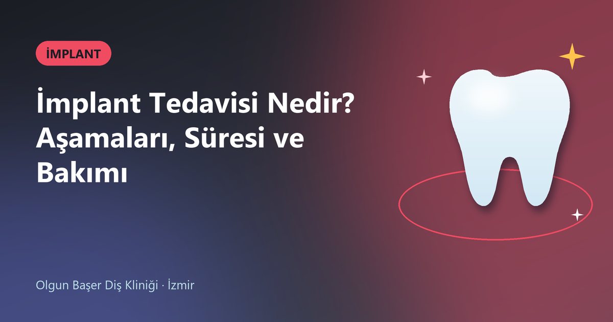 İmplant Tedavisi Nedir? Aşamaları, Süresi ve Bakımı – Olgun Başer Diş blog kapak görseli